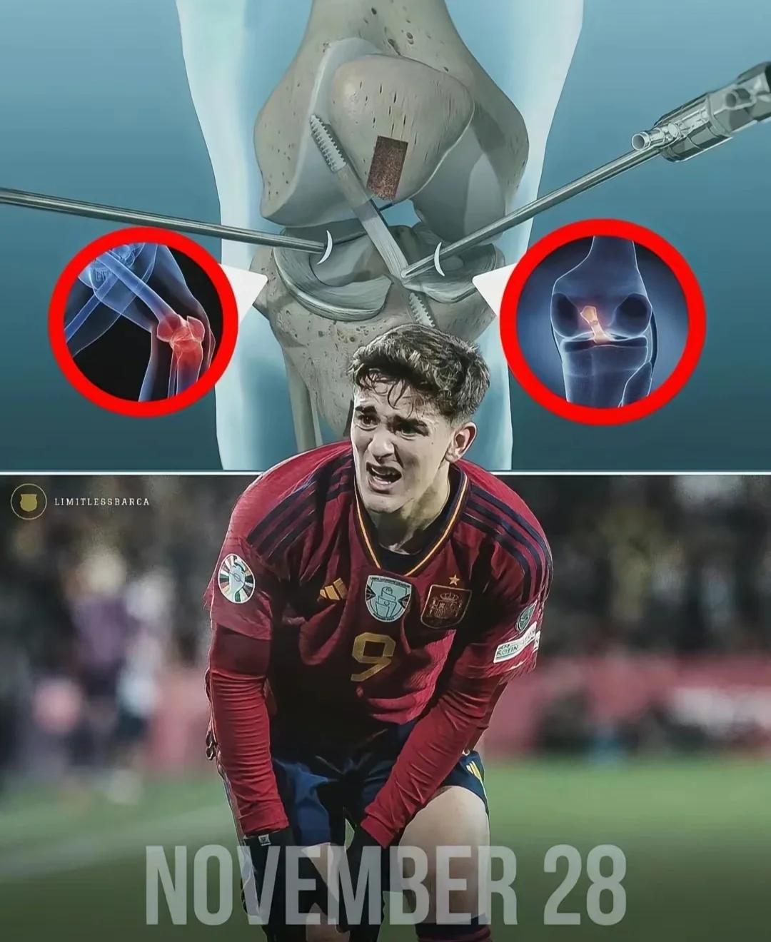 米兰电竞-斯图加特球员紧急受伤，或将缺席比赛(斯图加特主力球员)